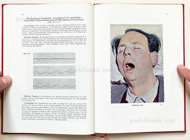 Sample page 8 for book Jörgen Schmidt-Voigt – Das Gesicht des Herzkranken. 