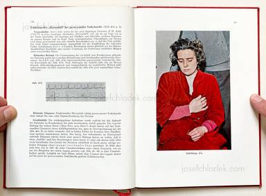 Sample page 12 for book Jörgen Schmidt-Voigt – Das Gesicht des Herzkranken. 