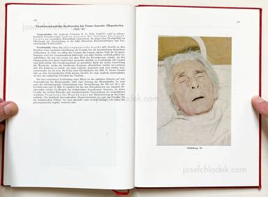 Sample page 13 for book Jörgen Schmidt-Voigt – Das Gesicht des Herzkranken. 