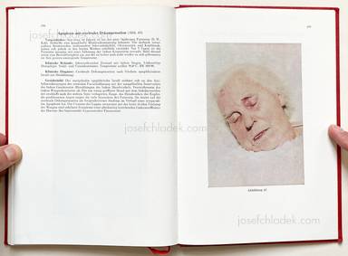Sample page 18 for book Jörgen Schmidt-Voigt – Das Gesicht des Herzkranken. 